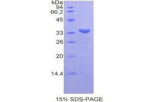 Image no. 1 for Cyclin-Dependent Kinase 7 (CDK7) (AA 12-295) protein (His tag) (ABIN1878428)