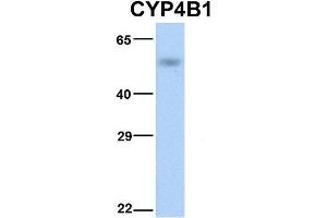 Image no. 4 for anti-Cytochrome P450, Family 4, Subfamily B, Polypeptide 1 (CYP4B1) (N-Term) antibody (ABIN2777006)