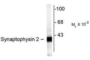 Image no. 1 for anti-Synaptoporin (SYNPR) (C-Term) antibody (ABIN372722)