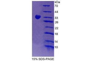 Image no. 1 for Signal-Regulatory Protein gamma (SIRPG) (AA 111-372) protein (His tag,T7 tag) (ABIN2126759)