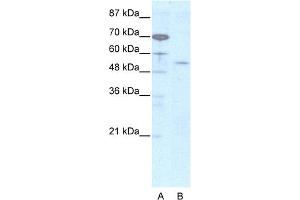 Image no. 1 for anti-Homeobox even-skipped homolog protein 2 (EVX2) (N-Term) antibody (ABIN2779394)