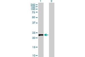 G Substrate antibody  (AA 1-155)
