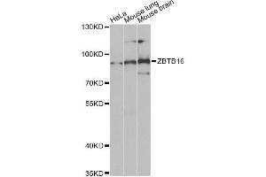 Image no. 2 for anti-Zinc Finger and BTB Domain Containing 16 (ZBTB16) antibody (ABIN2560811)