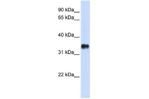 Image no. 1 for anti-Potassium Channel Tetramerisation Domain Containing 7 (KCTD7) (N-Term) antibody (ABIN633658)