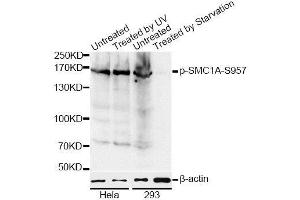 Image no. 4 for anti-Structural Maintenance of Chromosomes 1A (SMC1A) (pSer957) antibody (ABIN3019554)