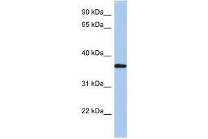Image no. 1 for anti-Low Density Lipoprotein Receptor Adaptor Protein 1 (LDLRAP1) (N-Term) antibody (ABIN2786138)