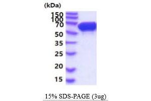 Image no. 1 for Stress-Induced-phosphoprotein 1 (STIP1) (AA 1-543) protein (His tag) (ABIN5854815)