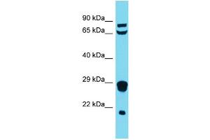 Image no. 1 for anti-Mitochondrial Ribosomal Protein L18 (MRPL18) (N-Term) antibody (ABIN2791669)