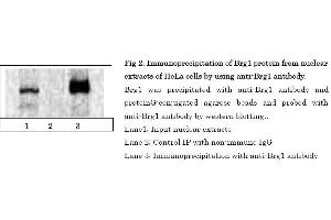 Image no. 6 for anti-SWI/SNF Related, Matrix Associated, Actin Dependent Regulator of Chromatin, Subfamily A, Member 4 (SMARCA4) (C-Term) antibody (ABIN2451926)