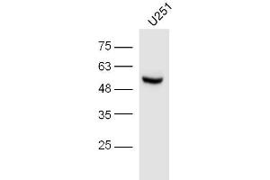 Image no. 3 for anti-Interferon Regulatory Factor 3 (IRF3) (pSer396) antibody (ABIN742688)