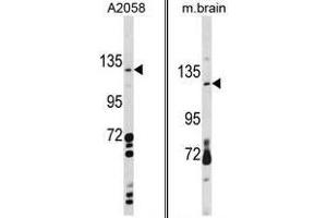 Image no. 1 for anti-C-Type Lectin Domain Family 16, Member A (CLEC16A) (C-Term) antibody (ABIN452846)