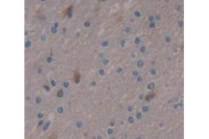 Image no. 2 for anti-Periplakin (PPL) (AA 1439-1716) antibody (ABIN1860293)