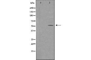 anti-Armadillo Repeat Containing 6 (ARMC6) (C-Term) antibody