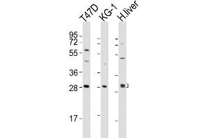 Image no. 2 for anti-Hepatitis A Virus Cellular Receptor 2 (TIM 3) (AA 167-194) antibody (ABIN1881402)