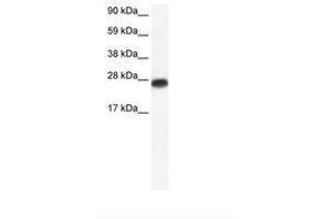 Image no. 1 for anti-Myogenic Factor 6 (MYF6) (AA 66-115) antibody (ABIN6735892)
