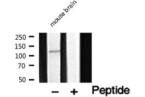 Image no. 1 for anti-FERM, RhoGEF and Pleckstrin Domain Protein 2 (FARP2) (Internal Region) antibody (ABIN6261751)