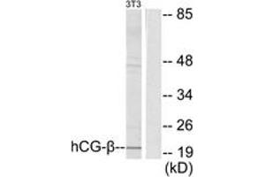 Image no. 1 for anti-HCG beta (AA 101-150) antibody (ABIN1533301)