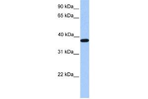 Image no. 1 for anti-Actin-Related Protein T2 (ACTRT2) (C-Term) antibody (ABIN2784953)