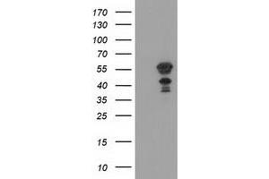 Image no. 4 for anti-Katanin P60 Subunit A-Like 1 (KATNAL1) antibody (ABIN1498985)