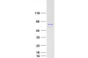 Image no. 1 for Phosphoinositide 3 Kinase, p85 alpha (PI3K p85a) (Transcript Variant 2) protein (Myc-DYKDDDDK Tag) (ABIN2728970)