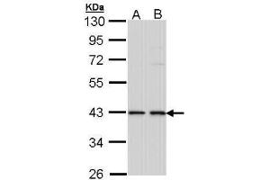 Image no. 1 for anti-E2F Transcription Factor 1 (E2F1) (Internal Region) antibody (ABIN2856879)