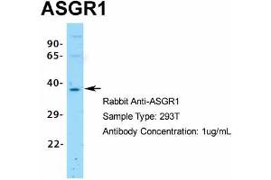 Image no. 6 for anti-Asialoglycoprotein Receptor 1 (ASGR1) (Middle Region) antibody (ABIN2778131)