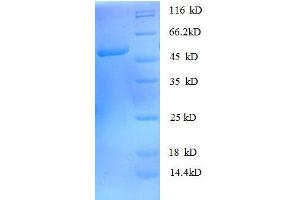 Image no. 1 for rho GDP Dissociation Inhibitor (GDI) alpha (ARHGDIA) (AA 2-204), (full length) protein (GST tag) (ABIN1607974)