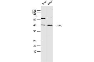 Arc Antikörper  (AA 101-200)