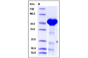 Image no. 1 for Protein Phosphatase, Mg2+/Mn2+ Dependent, 1A (PPM1A) (AA 1-382) protein (His tag) (ABIN2005363)
