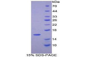 Image no. 1 for Platelet-Derived Growth Factor alpha Polypeptide (PDGFA) (AA 94-194) protein (His tag) (ABIN1880055)