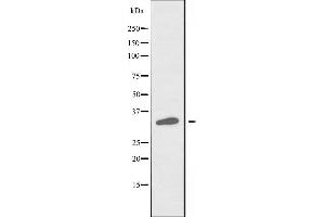 Image no. 3 for anti-Solute Carrier Family 25 (Mitochondrial Carrier, Adenine Nucleotide Translocator), Member 31 (SLC25A31) antibody (ABIN6258664)
