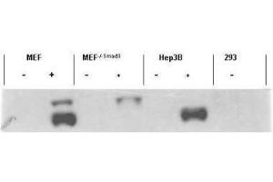 Western blot using  affinity purified anti-Smad3 pS423 pS425 antibody shows detection of endogenous Smad3 in stimulated cell lysates.