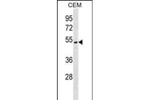 ONECUT2 Antibody (N-term) (ABIN1538931 and ABIN2848980) western blot analysis in CEM cell line lysates (35 μg/lane).