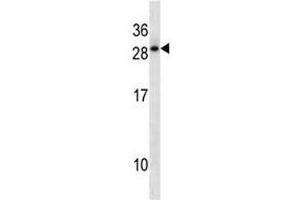 Image no. 1 for anti-Homeobox D12 (HOXD12) (AA 211-237) antibody (ABIN3031252)