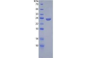 Image no. 1 for Angiopoietin 2 (ANGPT2) ELISA Kit (ABIN6730940)