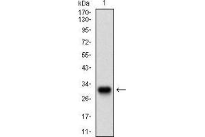 Image no. 5 for anti-Twist Homolog 1 (Drosophila) (TWIST1) (AA 9-74) antibody (ABIN1724845)