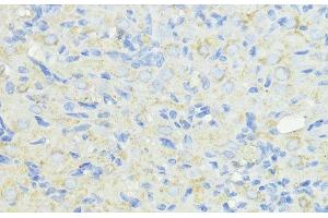 Immunohistochemistry of paraffin-embedded Rat ovary using CTSB Polyclonal Antibody at dilution of 1:100 (40x lens).