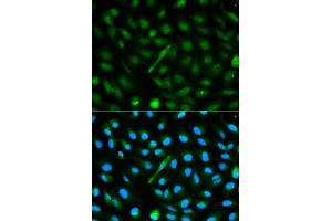 Image no. 1 for anti-alpha-2-HS-Glycoprotein (AHSG) antibody (ABIN3022317)
