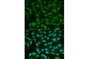 Image no. 4 for anti-Sorbitol Dehydrogenase (SORD) antibody (ABIN3022962)
