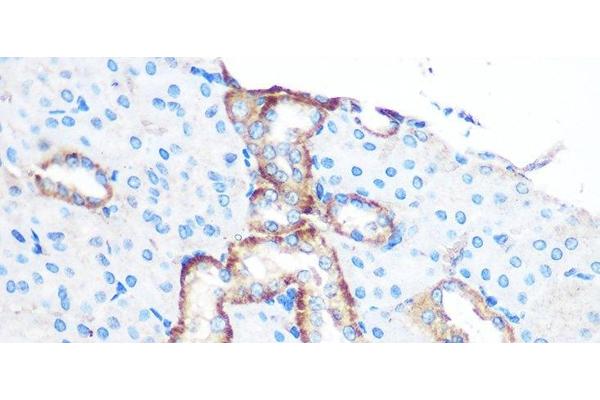 YTHDF2 antibody