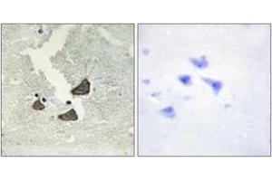 Image no. 2 for anti-EPH Receptor B6 (EPHB6) (AA 861-910) antibody (ABIN1533496)