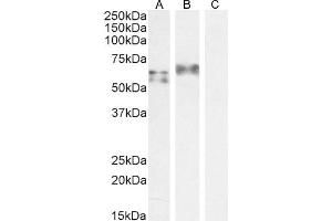 IRF5 antibody  (C-Term)