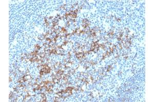 Image no. 3 for anti-Fc Fragment of IgE, Low Affinity II, Receptor For (CD23) (FCER2) (AA 48-321) antibody (ABIN6939372)