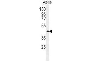 Image no. 3 for anti-Angiopoietin 2 (ANGPT2) (AA 409-440), (C-Term) antibody (ABIN950412)