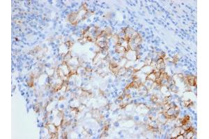 Image no. 3 for anti-Cadherin-16 (CDH16) (AA 371-507) antibody (ABIN6939023)