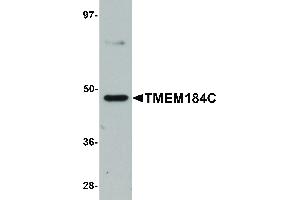 Image no. 1 for anti-Transmembrane Protein 184C (TMEM184C) (C-Term) antibody (ABIN6657268)