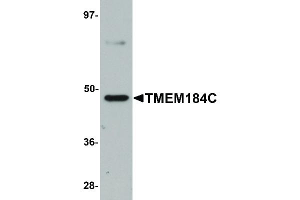 anti-Transmembrane Protein 184C (TMEM184C) (C-Term) antibody