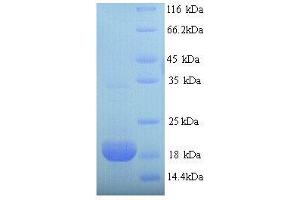 Erythropoietin (EPO) (AA 27-194), (full length) protein (His tag)