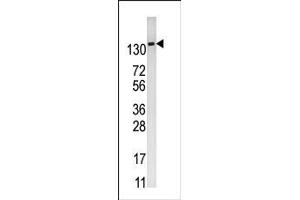 Image no. 2 for anti-6-phosphofructo-2-Kinase/fructose-2,6-Biphosphatase 2 (PFKFB2) (N-Term) antibody (ABIN360654)