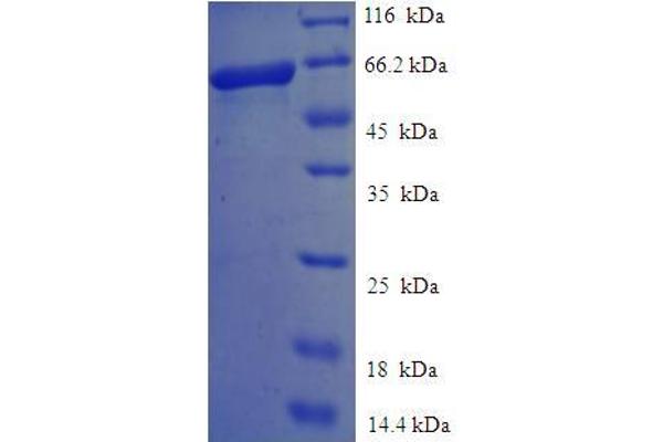 Endonuclease VIII-Like 1 (NEIL1) (AA 2-390) protein (His-SUMO Tag)